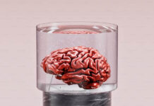 My Impressions of Psychiatry A brain in a jar