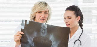 Are Antidepressants Weakening Women’s Bones?